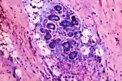 Higher-magnification tissue detail, lower region