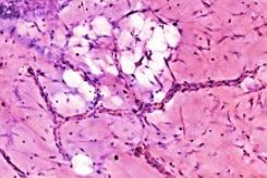 Higher-magnification tissue detail, upper region