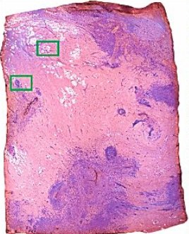 Supplied tissue image with two green boxes marking regions of interest